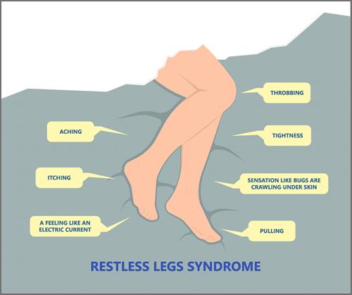 Drawing to show the symptoms of Restless Legs Syndrome