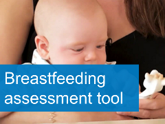 Breastfeeding assessment tool