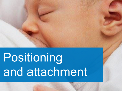Positioning and attachment