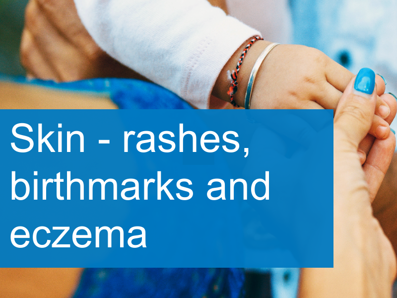 Rashes and birthmarks