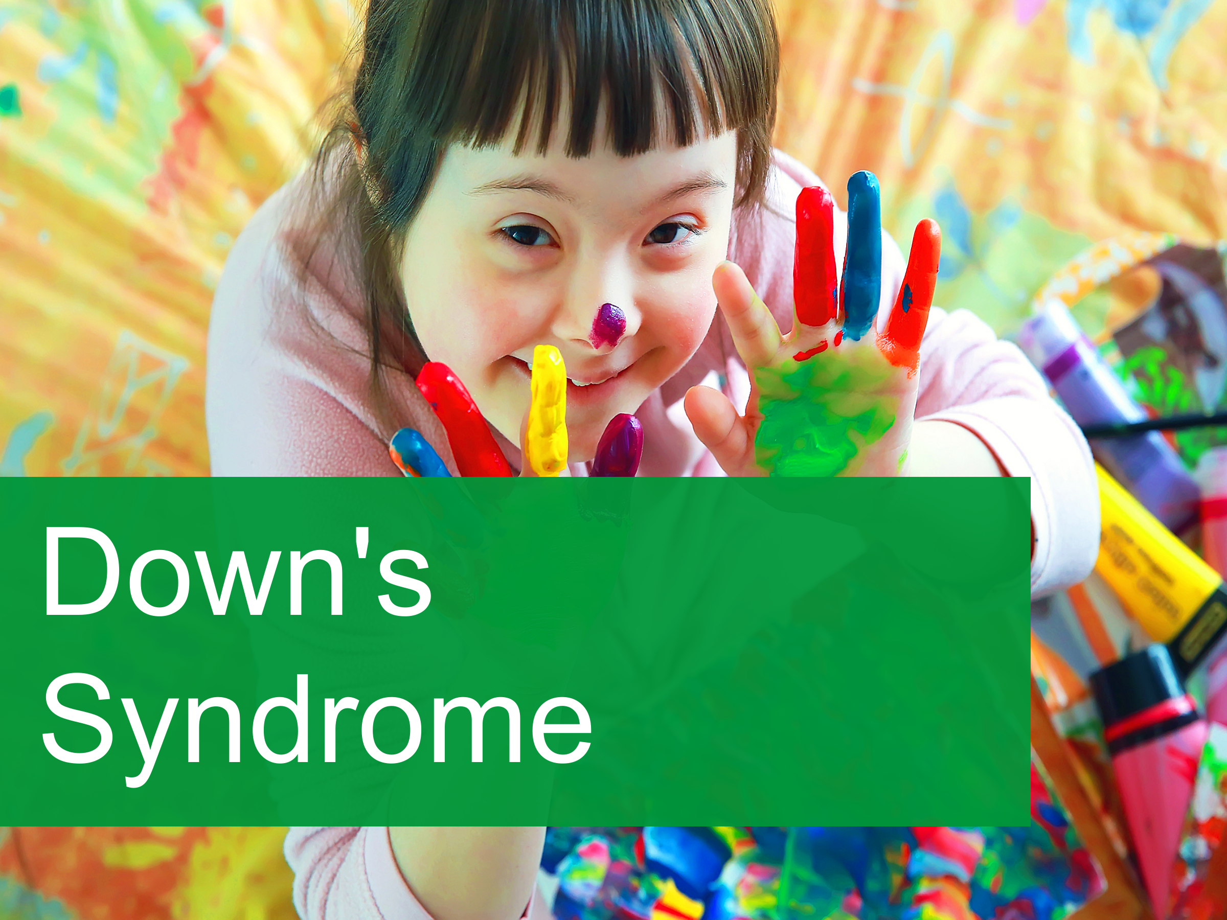 Down&#39;s Syndrome